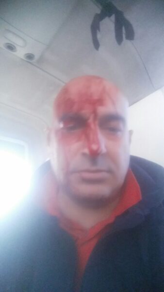 E gjakosën me leva, biznesmeni vlonjat i njohur për “bëmat” e tij hedh akuzën “bombë”