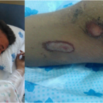 Mjeku e klasifikon ‘plagosje të lehtë’, 13-vjeçari bie në koma pas aksidentit