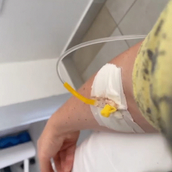 Këngëtarja e njohur shqiptare shtrohet në spital/ Çfarë ka ndodhur?