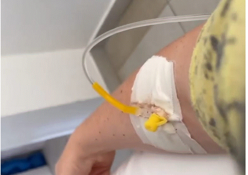 Këngëtarja e njohur shqiptare shtrohet në spital/ Çfarë ka ndodhur?