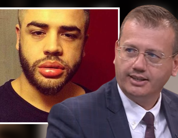 Kirurgu estetik: Meshkujt shqiptarë kërkojnë t’i bëjnë buzët si Noizy