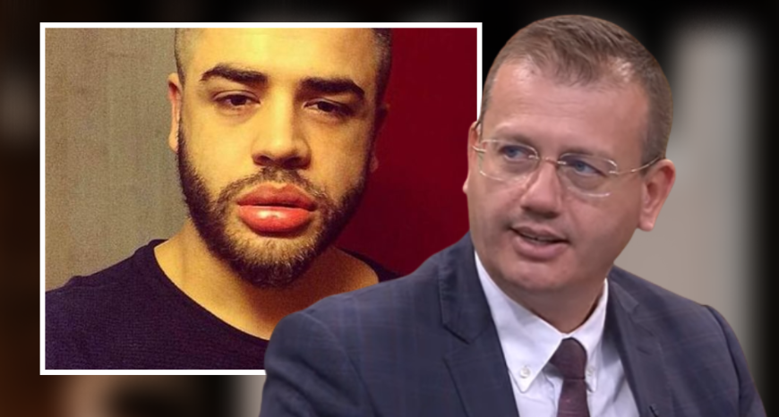 Kirurgu estetik: Meshkujt shqiptarë kërkojnë t’i bëjnë buzët si Noizy